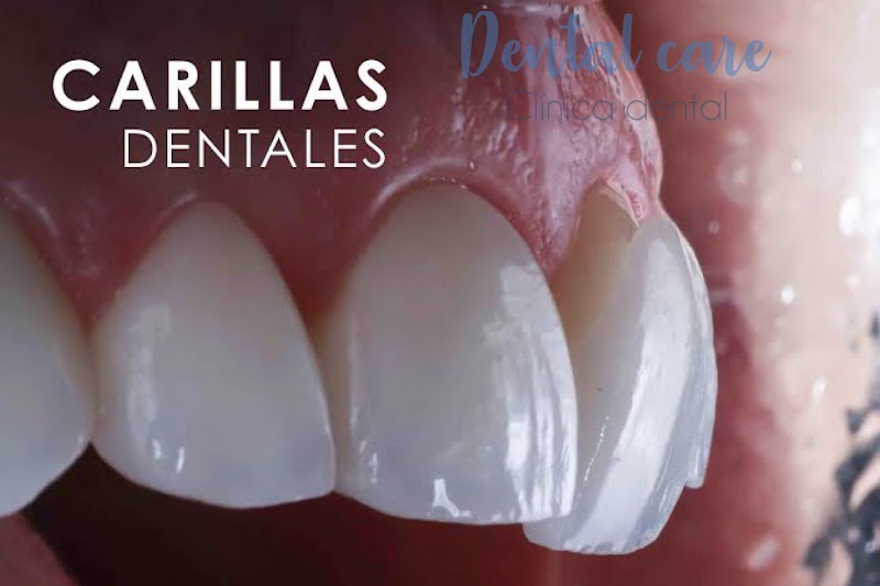 Dental Care Zamora , odontologia estetica e implantologia - Imagen 1