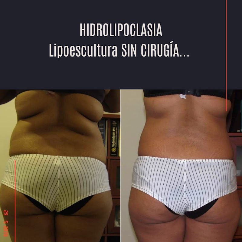 Dr. Cesar Omar Rodríguez Perez , Estética Médica
