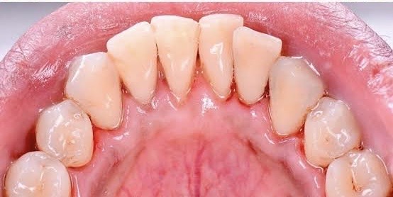 Dentista Lucero Castillo (ortodoncia y ortopedia maxilar) - Imagen 1