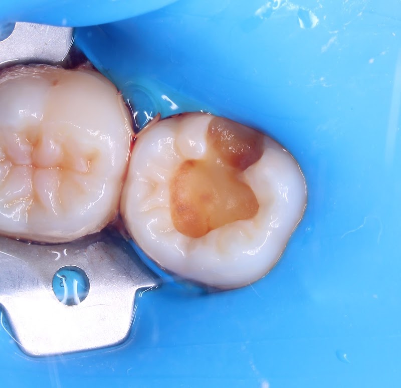 OBE-Dental - Imagen 1